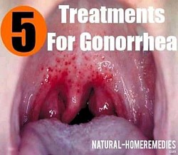 treatment for ghonorea